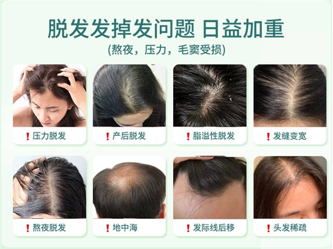 洗发水哪个牌子最好用最安全？洗发水畅销榜推荐！防脱固发表现突出