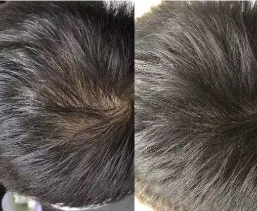 洗发水排行榜口碑最好十大洗发水！防脱生发效果值得推荐