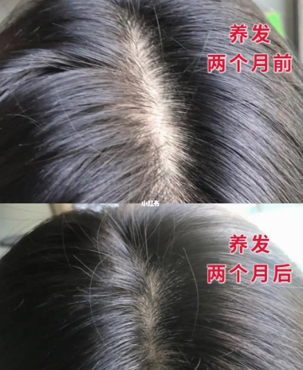 洗发水排行榜口碑最好十大洗发水！防脱生发效果值得推荐